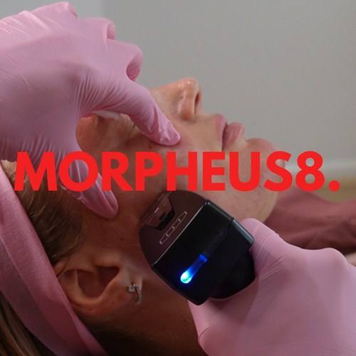 <h3>MORPHEUS8.</h3>